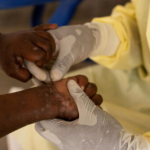 DRC: Kinshasa lifts the Mpox-related public health emergency
